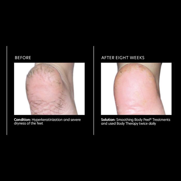 PCA Skin Body Therapy 7 oz - European Beauty by B