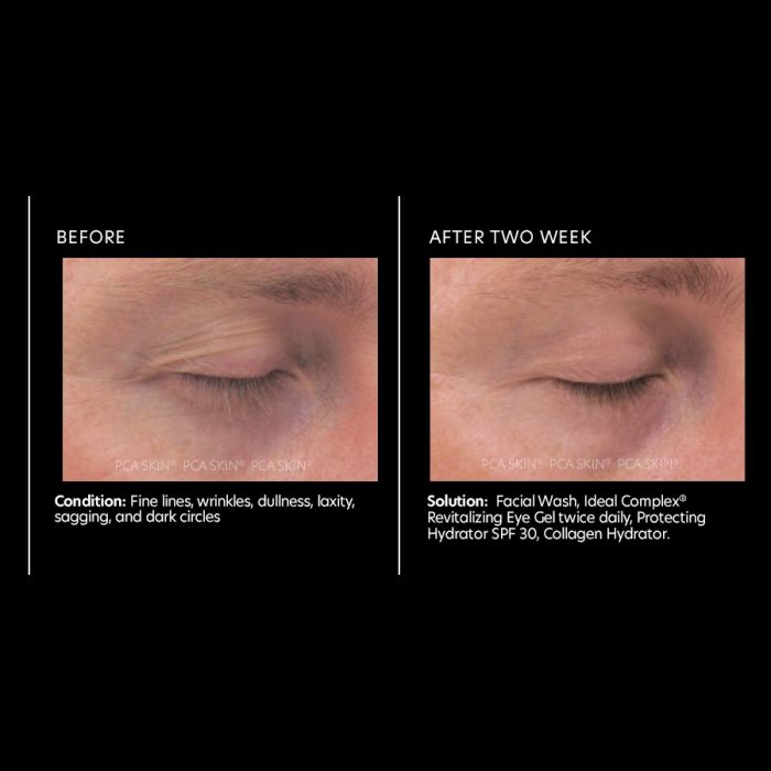 PCA Skin Ideal Complex® restorative eye cream 0.5 oz - European Beauty by B
