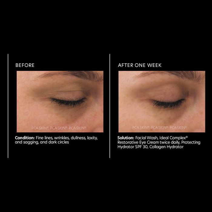 PCA Skin Ideal Complex® restorative eye cream 0.5 oz - European Beauty by B