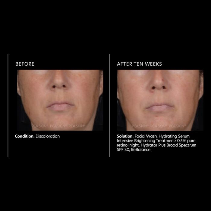 PCA Skin Intensive Brightening Treatment: 0.5% pure retinol 1 oz - European Beauty by B