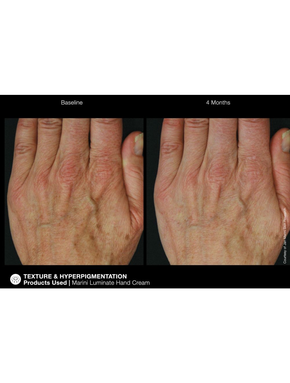 Jan Marini Marini ReNu Corrective Hand Complex - European Beauty by B