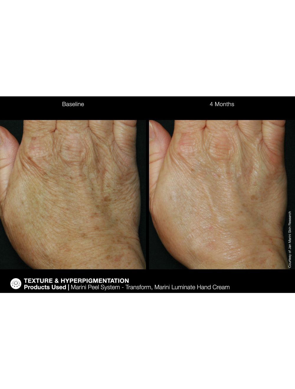 Jan Marini Marini ReNu Corrective Hand Complex - European Beauty by B