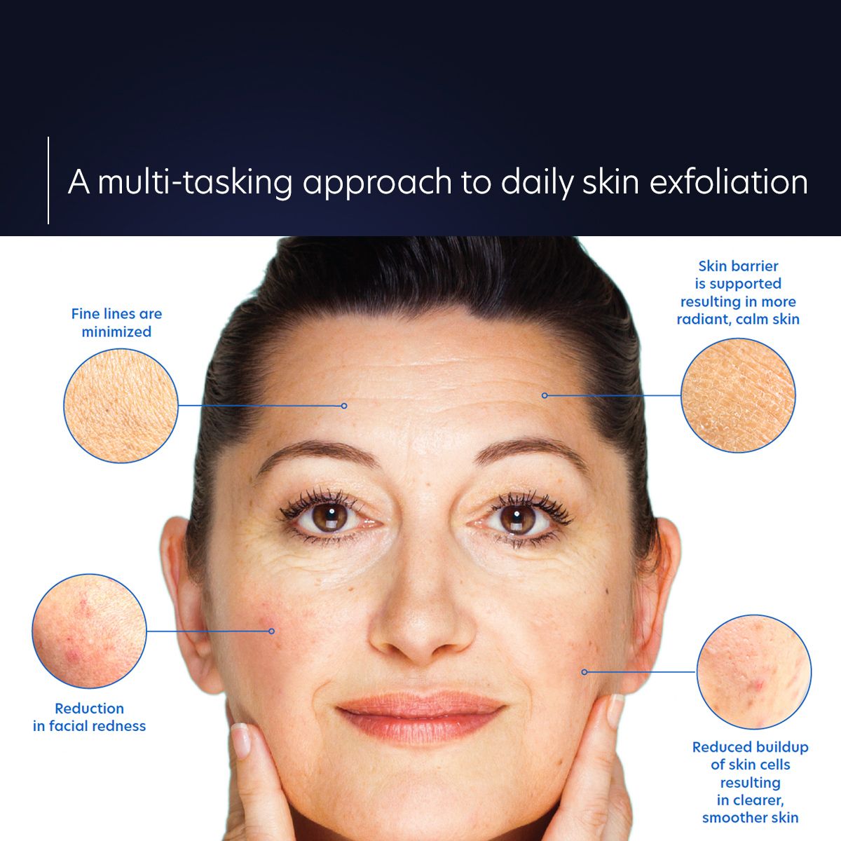 PCA Skin Resurfacing Serum 1 fl oz