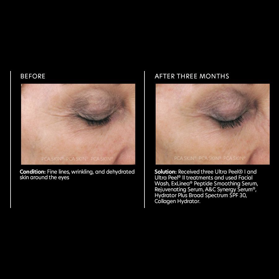 PCA Skin Rejuvenating Serum 1 fl oz - European Beauty by B