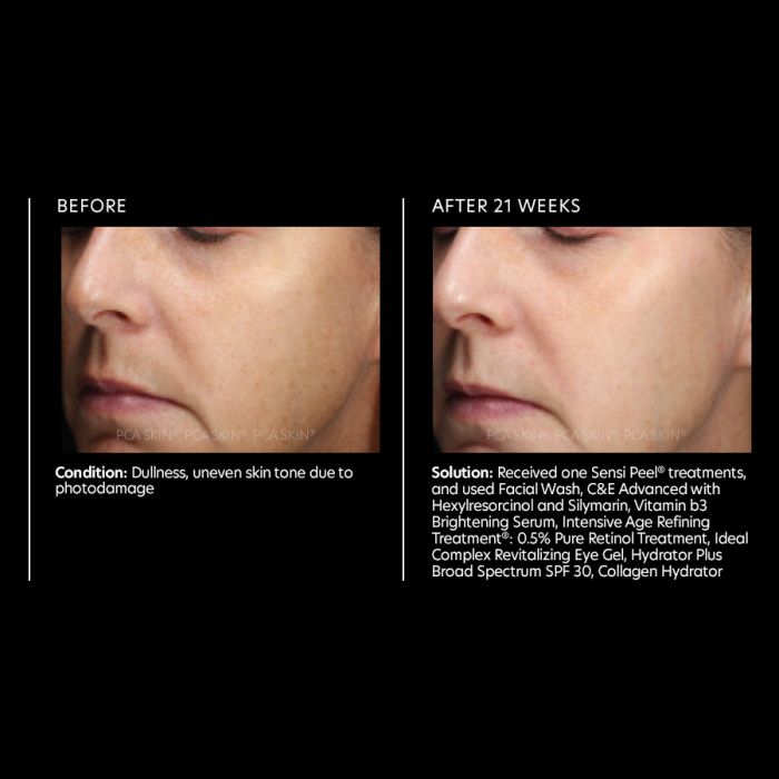 PCA Skin Vitamin B3 Eye Brightening Serum