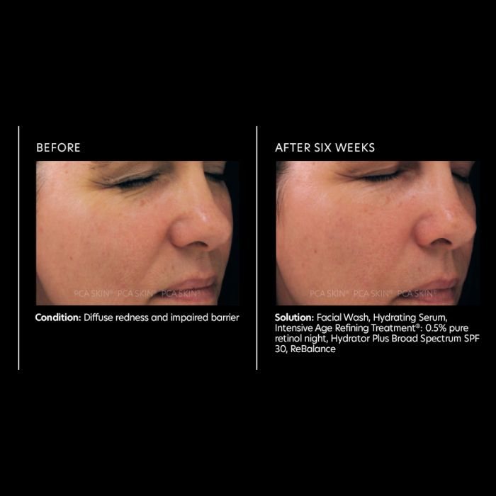 PCA Skin Intensive Age Refining Treatment 0.5% pure retinol 1 oz - European Beauty by B